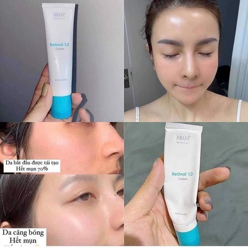 kem chong lao hoa retinol 1.0